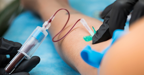 Blood Test